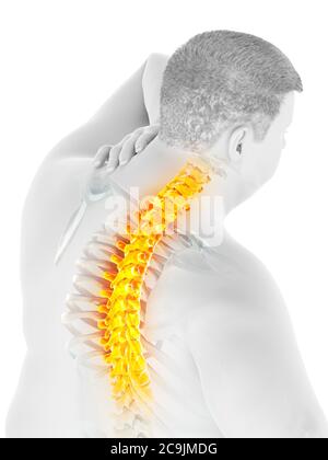 Obese man with back pain, computer illustration. Stock Photo