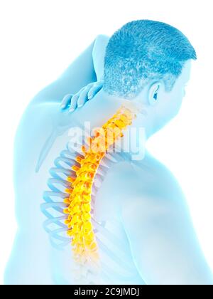 Obese man with back pain, computer illustration. Stock Photo