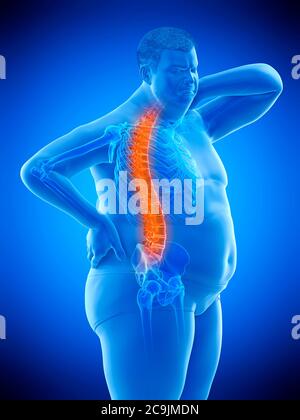 Obese man with back pain, computer illustration. Stock Photo