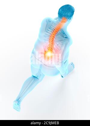 Obese runner with back pain, computer illustration. Stock Photo