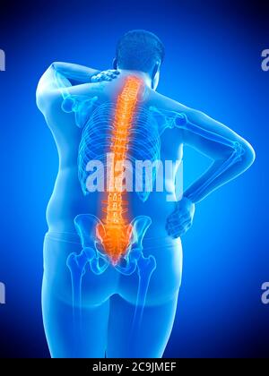 Obese man with back pain, computer illustration. Stock Photo