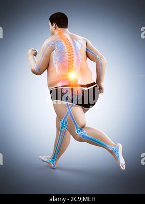 Obese runner with back pain, computer illustration. Stock Photo