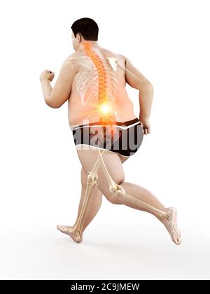 Obese runner with back pain, computer illustration. Stock Photo