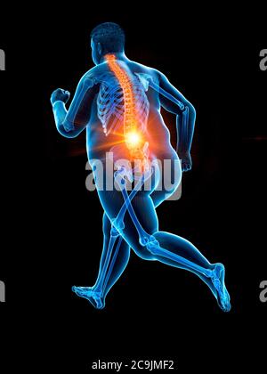 Obese runner with back pain, computer illustration. Stock Photo