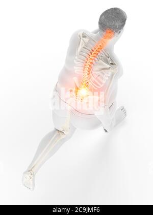 Obese runner with back pain, computer illustration. Stock Photo