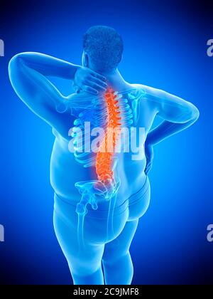 Obese man with back pain, computer illustration. Stock Photo