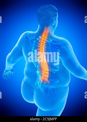 Obese man with back pain, computer illustration. Stock Photo