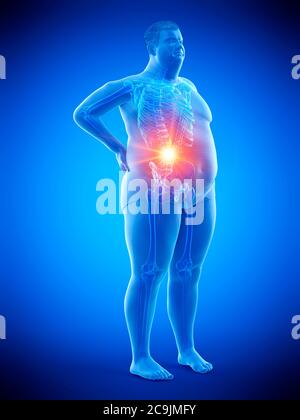 Obese man with back pain, computer illustration. Stock Photo