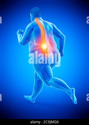 Obese runner with back pain, computer illustration. Stock Photo