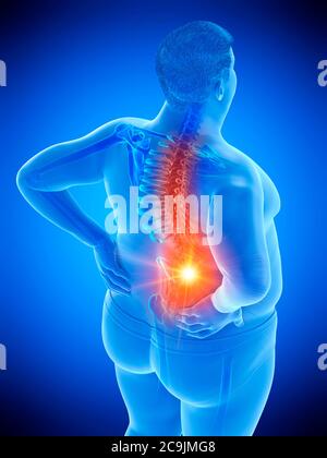 Obese man with back pain, computer illustration. Stock Photo