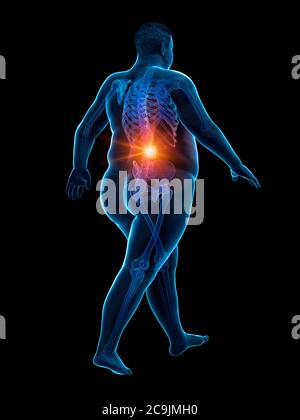 Obese runner with back pain, computer illustration. Stock Photo