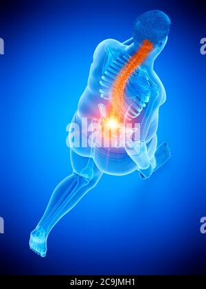 Obese runner with back pain, computer illustration. Stock Photo