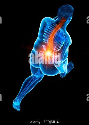 Obese runner with back pain, computer illustration. Stock Photo