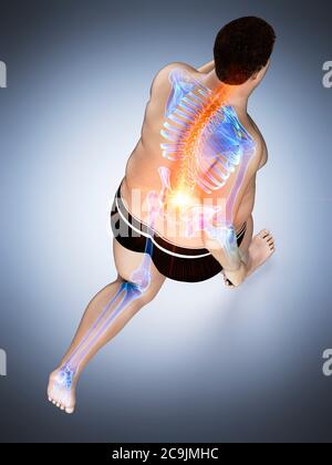 Obese runner with back pain, computer illustration. Stock Photo