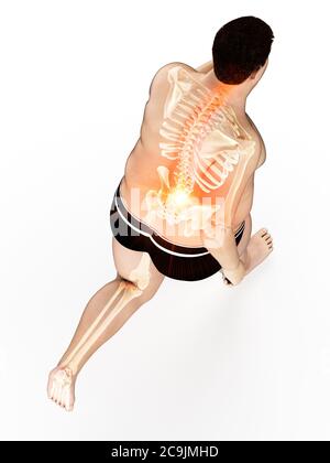 Obese runner with back pain, computer illustration. Stock Photo