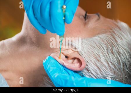 Auriculotherapy, or auricular treatment on human ear, close up. Therapist's hand applying acupuncture ear seed sticker with tweezers. Stock Photo