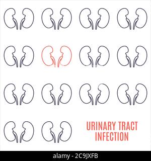 Urinary tract infection, conceptual illustration. Stock Photo