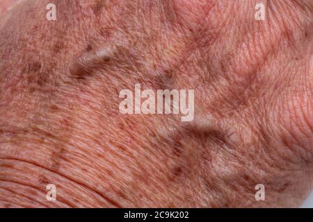 Age, or liver, spots on an elderly woman's hand. Stock Photo