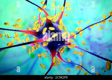 Bacterial encephalitis. Conceptual computer illustration showing bacteria infecting brain cells. Stock Photo