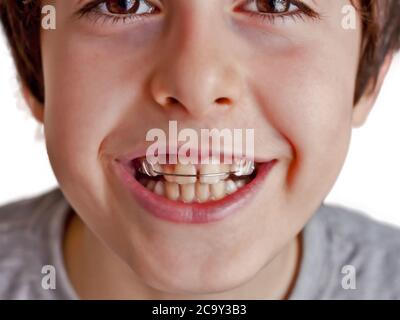 Portrait of happy boy with braces Stock Photo