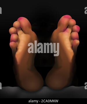 Covid Toes, a red rash on the toes of coronavirus patients is seen in this illustration. Stock Photo
