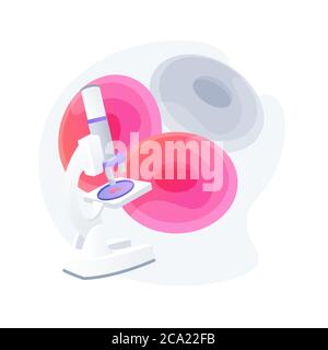 Anemia screening abstract concept vector illustration. Stock Vector