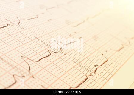 Texture of pulsed waves. Cardiogram on a sheet of paper close-up. Stock Photo