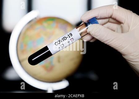 Test tube with covid-19 blood sample in hands on globe background. Doctor with positive coronavirus test against the map of Europe, Africa and Asia Stock Photo