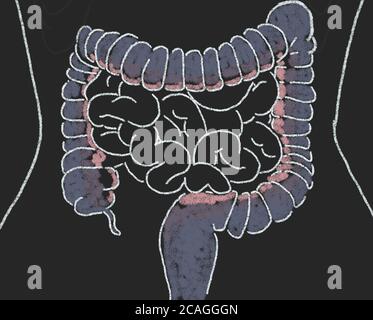 Gut bacteria , gut flora, microbiome. Bacteria inside the small intestine, concept, representation. 3D illustration. Stock Photo