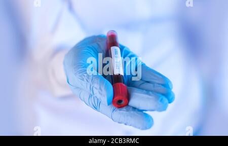 Doctor holding a test tube with blood sample for COVID-19 SARS-CoV-2 Lab test. (Shallow DOF)