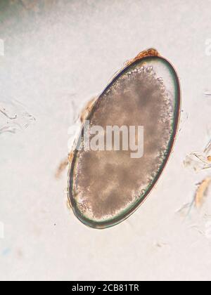 ear mite egg from a cat, under the microscope Stock Photo - Alamy