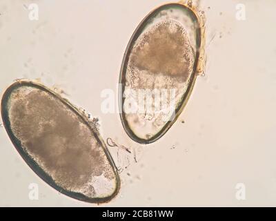 ear mite egg from a cat, under the microscope Stock Photo - Alamy