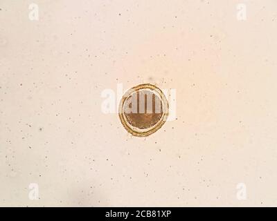 toxocara cati egg under the microscope Stock Photo - Alamy