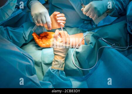 two doctors operate on a wrist fracture in an operating theatre Stock Photo