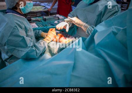 two doctors operate on a wrist fracture in an operating theatre Stock Photo