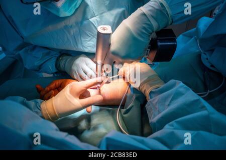 two doctors operate on a wrist fracture in an operating theatre Stock Photo