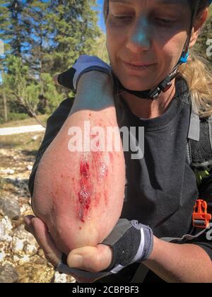 Female mountain biker looking at her bleeding graze on her forearm after a fall, Rofan Mountains, Steinberg am Rofan, Tyrol, Austria Stock Photo