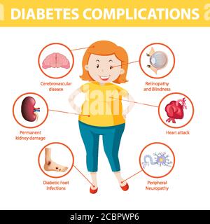 Diabetes complications information infographic illustration Stock Vector