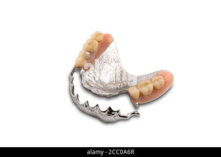 Partial metal removable swinglock denture isolated on white background with clipping path. Stock Photo