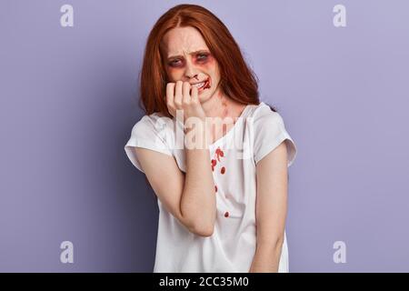 scared crying girl with bruises and wounds marks on her face after a case of gender violence, closeup portrait, isolated blue background, studio shot. Stock Photo