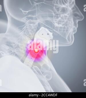 Tooth ache, pain. Human anatomy head xray like image. 3D illustration. Stock Photo