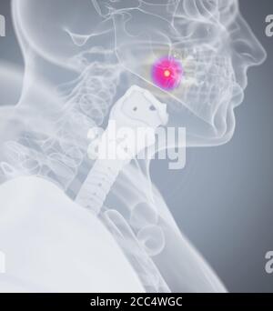 Tooth ache, pain. Human anatomy head xray like image. 3D illustration. Stock Photo