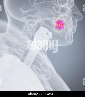 Tooth ache, pain. Human anatomy head xray like image. 3D illustration. Stock Photo