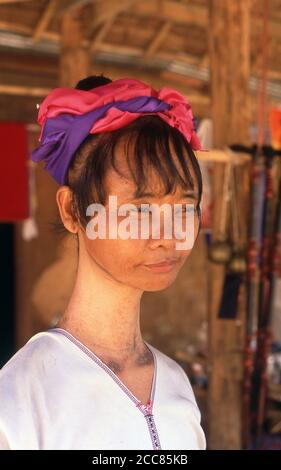 Thailand: A Padaung (Long Neck Karen) woman after removing her neck rings  for cleaning, Stock Photo, Picture And Rights Managed Image. Pic.  GBP-CPA0036998