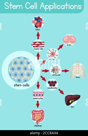 Informative poster of stem cell applications illustration Stock Vector ...
