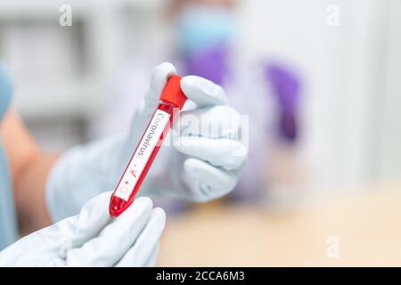Nurse holding test tube with blood for 2019-nCoV analyzing to negative. Novel Chinese Coronavirus blood test Concept. Stock Photo