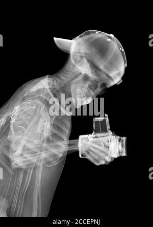 Skeleton photographer, X-ray