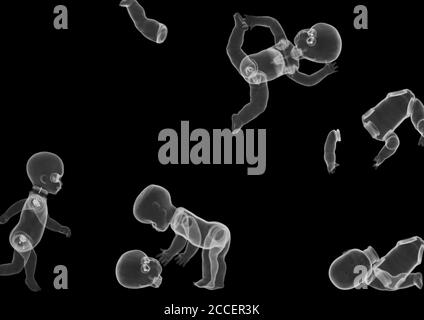 Plastic baby doll toys, X-ray Stock Photo