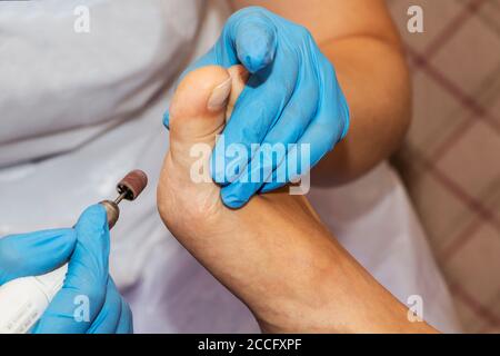 Professional pedicure using dieffenbach scalpel.Patient visiting  podiatrist.Medical pedicure procedure using special instrument with blade  knife Stock Photo - Alamy