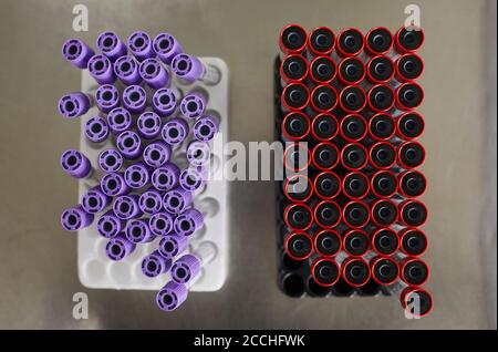 High angle view of test tubes with blood samples on the table at hospital Stock Photo
